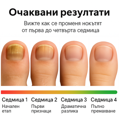 Heriva™ Подхранващи лепенки за по-здрави и красиви нокти