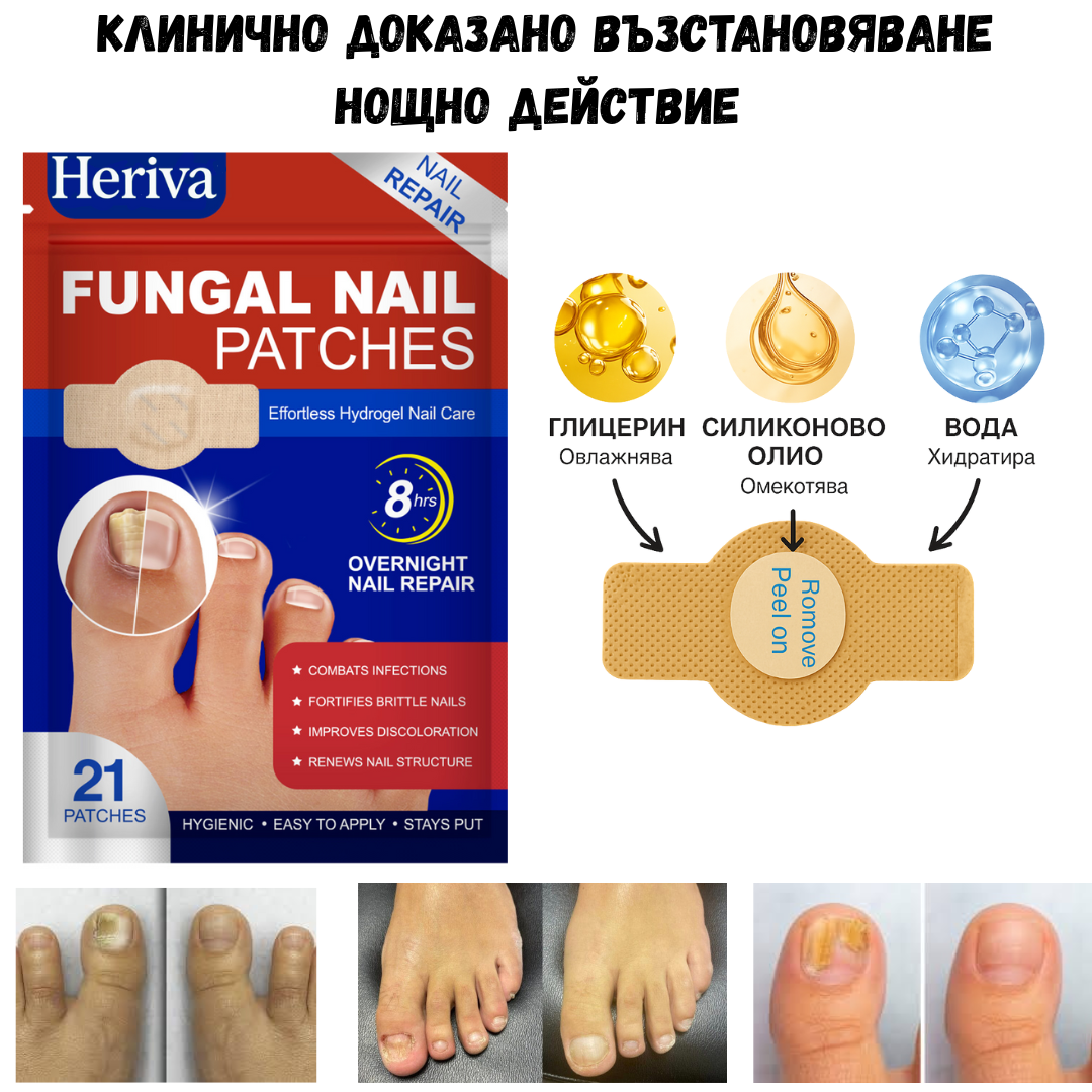 Heriva™ Подхранващи лепенки за по-здрави и красиви нокти